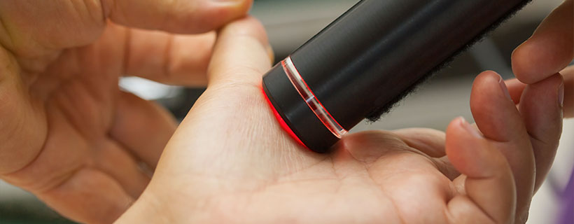 patient receiving cold laser therapy in El Cerrito CA