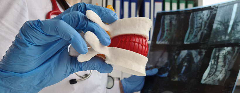 patient needing herniated disc chiropractor in El Cerrito CA